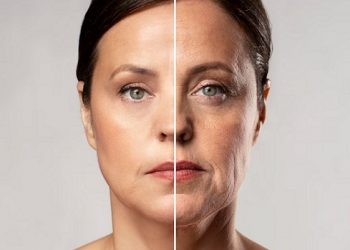 Tanpa Perawatan Mahal, Ini Cara Alami untuk Atasi Kulit Keriput