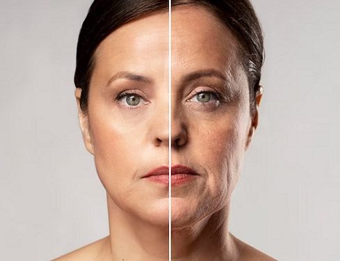 Tanpa Perawatan Mahal, Ini Cara Alami untuk Atasi Kulit Keriput