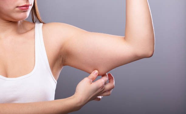 Tidur yang Cukup hingga Diet Sehat Bisa Bantu Hilangkan Lemak di Lengan, Ini Penjelasannya!