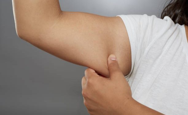 Sederet Pilihan Alat Gym untuk Hilangkan Lemak di Lengan, Terbukti Cepat Teratasi!