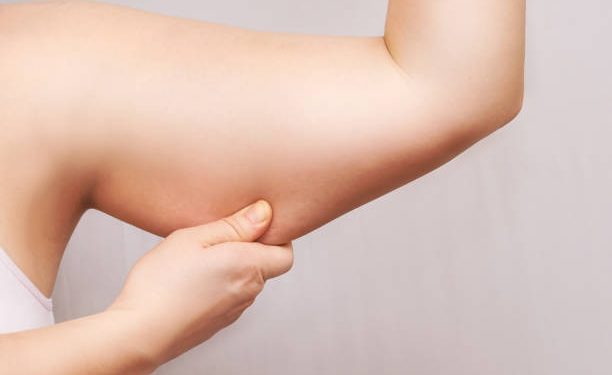 Lemak di Lengan Bikin Susah Percaya Diri? Coba Atasi dengan 5 Treatment Ini