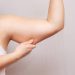 Lemak di Lengan Bikin Susah Percaya Diri? Coba Atasi dengan 5 Treatment Ini