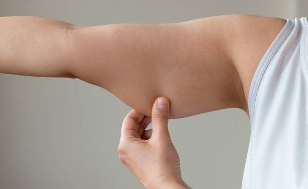 Susah Hilangkan Lemak di Lengan? Ini 6 Rekomendasi Jenis Olahraga yang Efektif Mengatasi