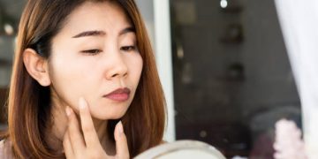 5 Penyebab Ini Memicu Bibir Jadi Hitam Tanpa Disadari, Cek Sekarang!
