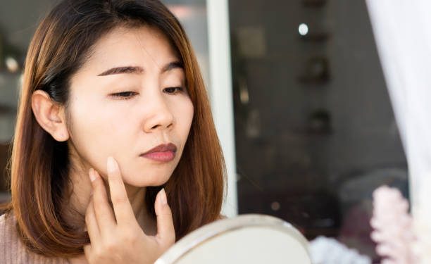 5 Penyebab Ini Memicu Bibir Jadi Hitam Tanpa Disadari, Cek Sekarang!