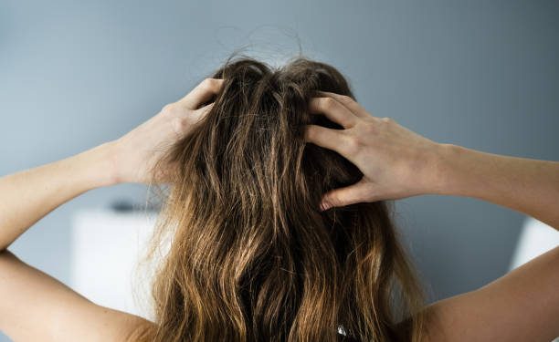 Katanya Ketombe Bisa Menular, Fakta Atau Mitos? Temukan Jawabannya Disini!