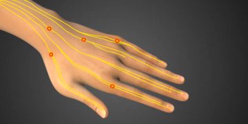 Jangan Anggap Sepele! Sering Kesemutan Bisa Jadi Tanda 6 Penyakit Ini