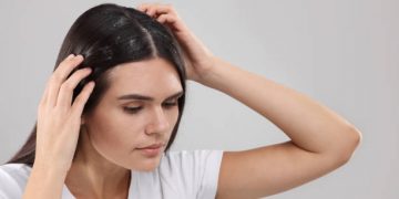 Ini 5 Rekomendasi Shampo untuk Atasi Ketembo dengan Cepat, Terbukti Ampuh!