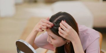 Ini Jenis-jenis Ketombe Dilihat Berdasarkan Penyebabnya, Cek Sekarang!