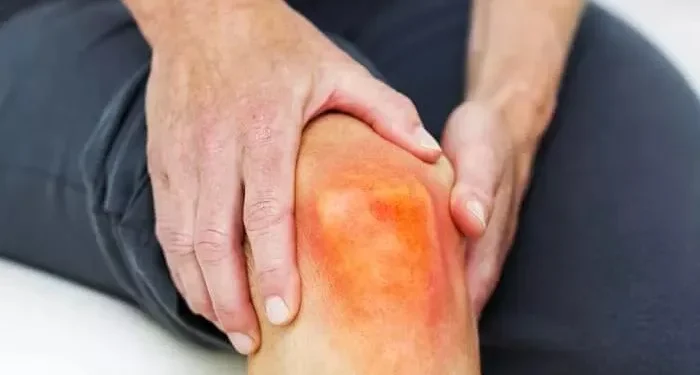 Jangan Asal-asalan! Ini 7 Jenis Makanan yang Pantang Dikonsumsi untuk Penderita Asam Urat