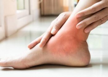 Baik untuk Kesehatan, Ini Kebiasaan yang Ampuh Mencegah Asam Urat, Jangan Abaikan!